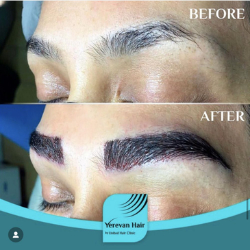 Slider image (5) United Hair Clinic